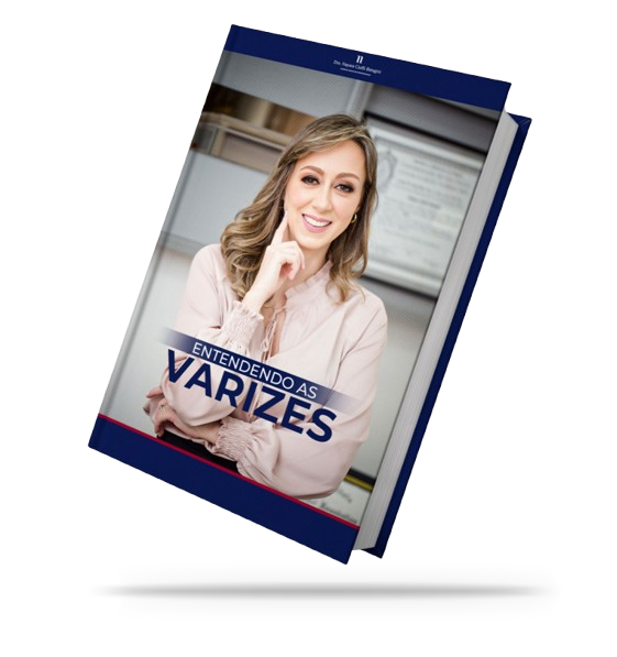 Ebook - Varizes