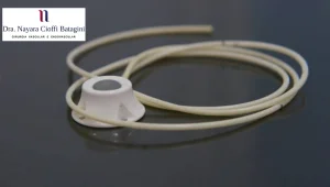 Cateter Port A Cath para Quimioterapia