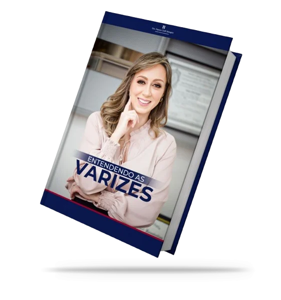 Ebook - Varizes
